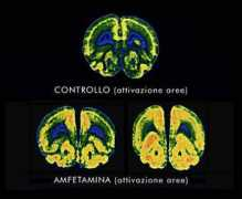 Amfetamine