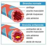 Bronche