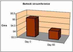 Buttock