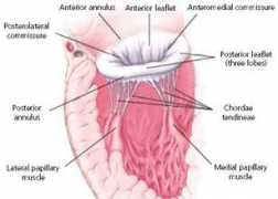 Mitral