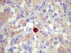 anatpat.unicamp.br Altemani