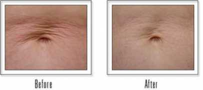 aestheticlasersolutions.com Atitan