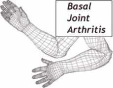 eatonhand.com Basalp