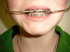 members.chello.nl Beuten