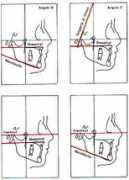 cleber.com.br Bimler