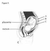 b.brahim.free.fr Coeliaque