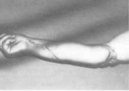 Fasciaux