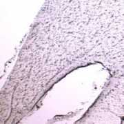 Fornix