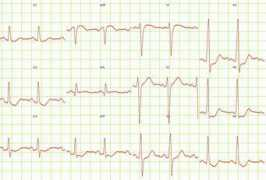 pl.wikidoc.org Ganseman