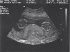 twins.hinkelfamily.us Imgone