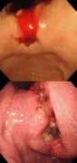 gastrohep.com Jsung