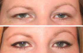 Myeyes