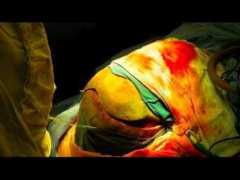 article.wn.com Neurocirugia