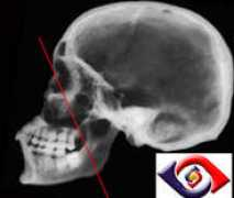 Ohngren