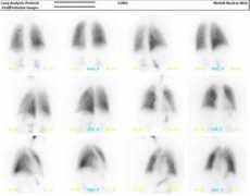 norfolknuclear.com Perfusion