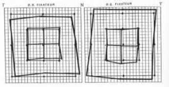 orthoptie.net Putteman