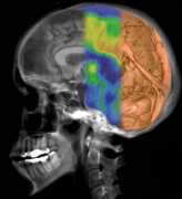 radiol.uu.se Radiologi