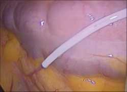 gynecendoscopy.org Sankpal