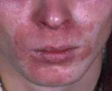 users.telenet.be Seborro