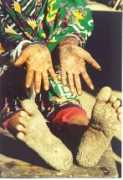 sos-arsenic.net Tanore