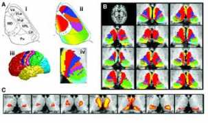 Thalamus