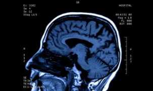 prescription-drug.addictionblog.org Ultram