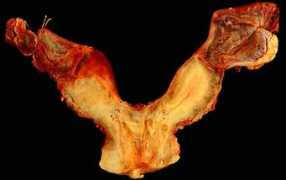 web2.airmail.net Uterus