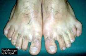 bijbelaantekeningen.nl Vingers